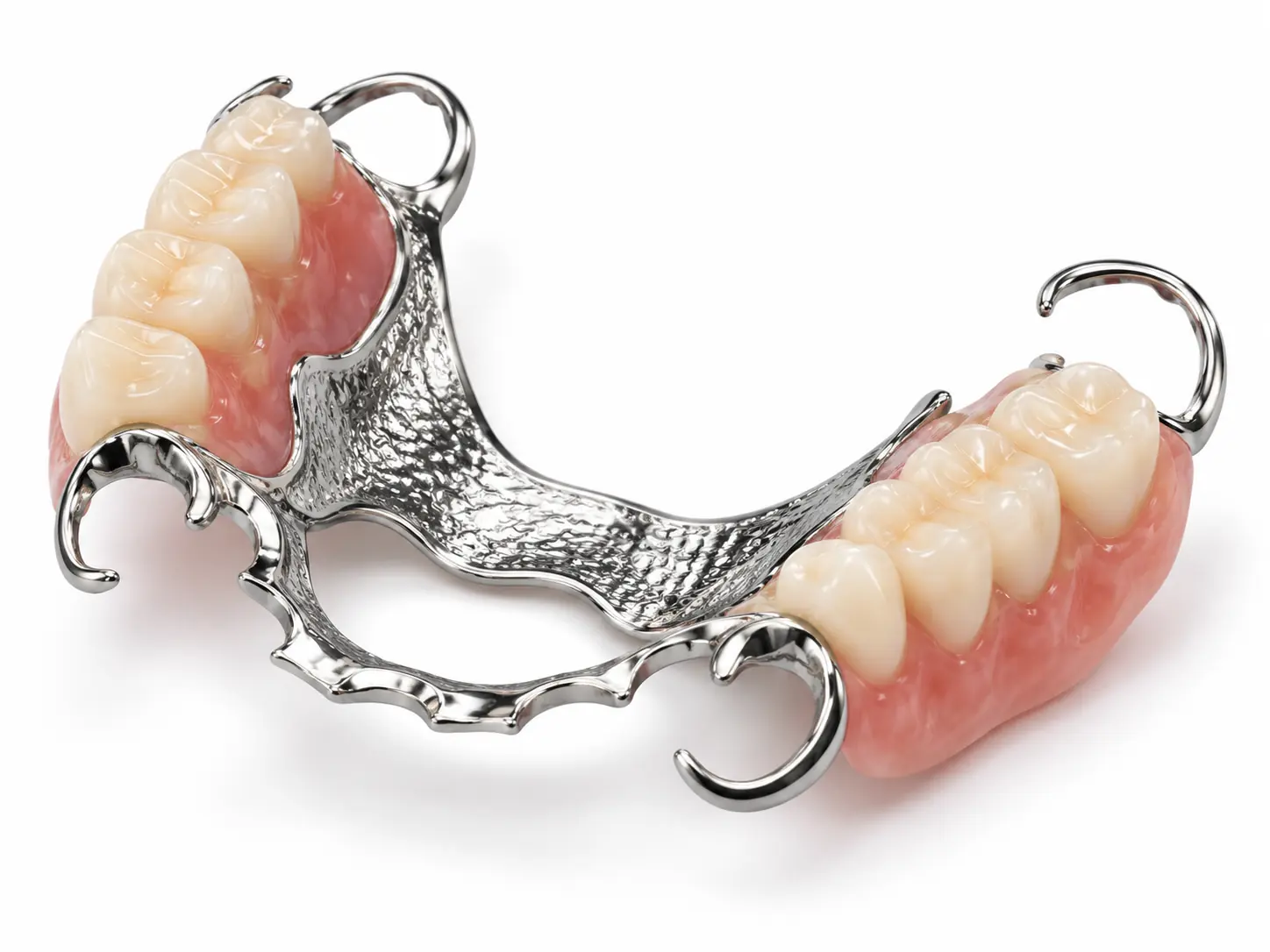 Dental product illustration of cast metal partial dentures