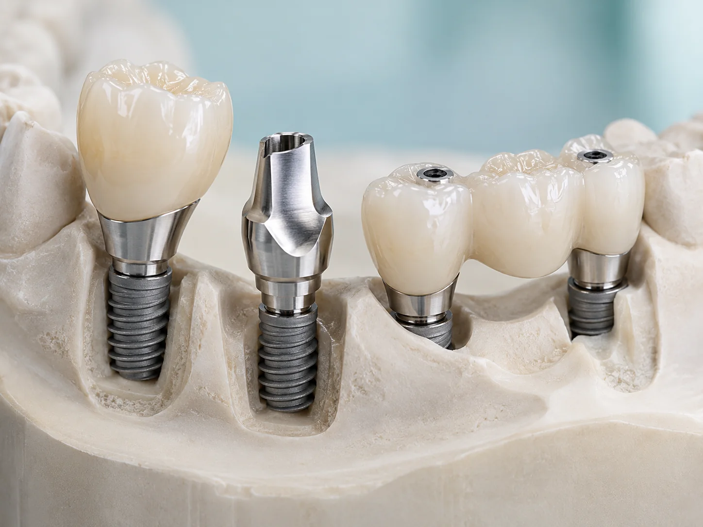 Dental product illustration