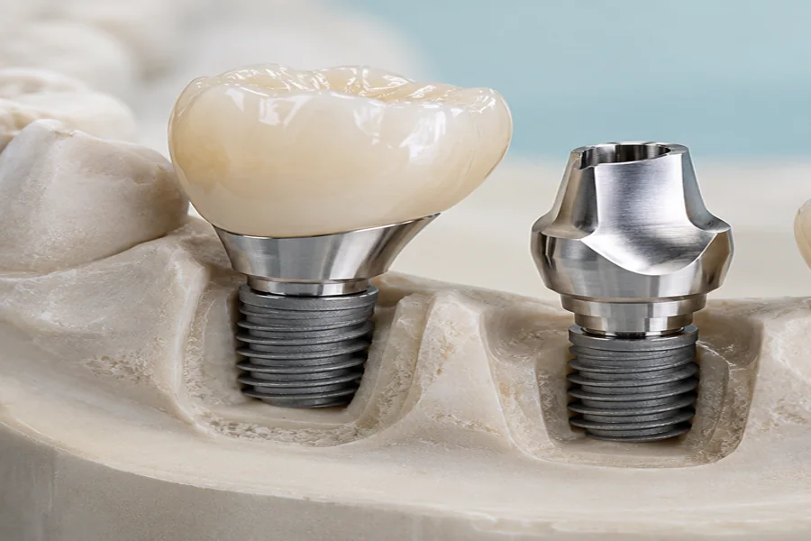 Dental product illustration of Implant-Supported Crowns