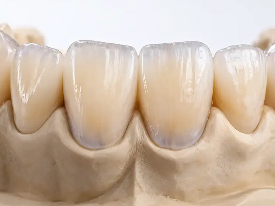 Central incisor detail